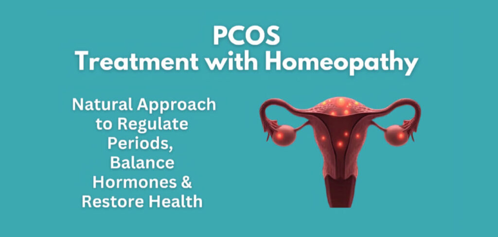 pcos-treatment-banner